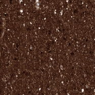 NBP1-80962 - TPPP