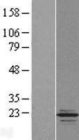 NBL1-17225 - TPPP2 Lysate