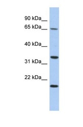 NBP1-56560 - TPRG1