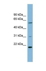 NBP1-56860 - TPRKB