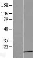 NBL1-17228 - TPRKB Lysate