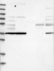 NBP1-86023 - TPST2