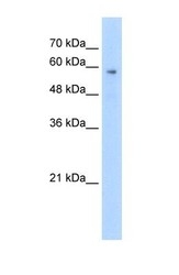 NBP1-58242 - TPTE