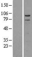NBL1-17236 - TPX2 Lysate