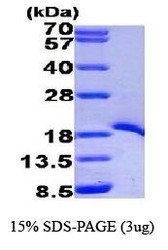 NBP1-44457 - TRAF1 / EBI6