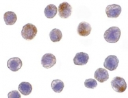 NBP1-76642 - TRAF3 / CRAF1