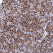 NBP1-86639 - TRAF3 / CRAF1