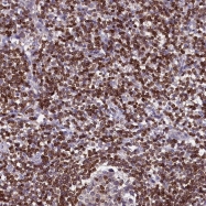 NBP1-86974 - TRAF3IP3 / T3JAM