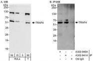 NBP1-47305 - TRAF4 / RNF83