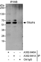 NBP1-47306 - TRAF4 / RNF83