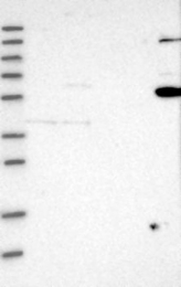 NBP1-80825 - TRAF6 / RNF85