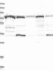 NBP1-87125 - TRAIP / RNF206