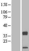 NBL1-17254 - TRAM2 Lysate