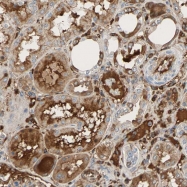 NBP1-87221 - Transferrin