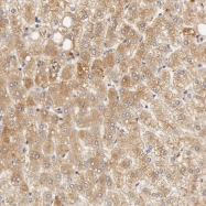 NBP1-87222 - Transferrin