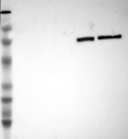 NBP1-87222 - Transferrin