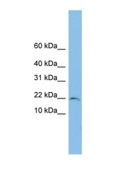 NBP1-57715 - TRAPPC1