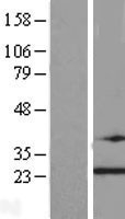 NBL1-17259 - TRAPPC4 Lysate