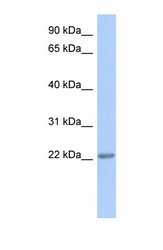 NBP1-56296 - TRAPPC5