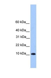 NBP1-70736 - TRAPPC6B