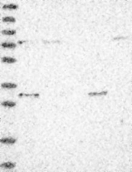 NBP1-80665 - TSNAX / TRAX