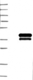 NBP1-84235 - TREML1