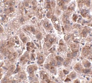 NBP1-76978 - TREX2