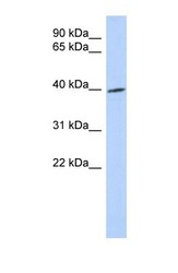 NBP1-55386 - TRIB1