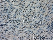 NBP1-48030 - TRIB2
