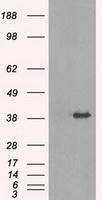 NBP1-48030 - TRIB2