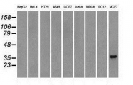 NBP1-48030 - TRIB2