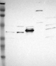 NBP1-83326 - TRIB2