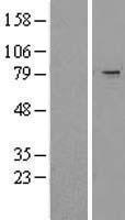 NBL1-17280 - TRIM2 Lysate