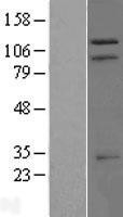NBL1-17293 - TRIM37 Lysate