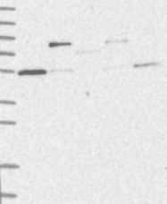 NBP1-87126 - TRIM38 / RNF15