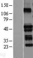 NBL1-17308 - TRIM58 Lysate