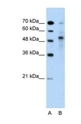 NBP1-59777 - TRIM59 / TSBF1 / RNF104