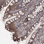 NBP1-83489 - TRIML1 / RNF209