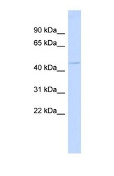 NBP1-56794 - TRIML2 / SPRYD6
