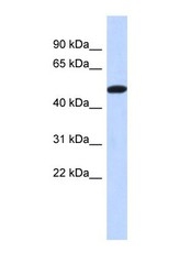 NBP1-56795 - TRIML2 / SPRYD6
