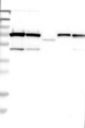 NBP1-90589 - TRIOBP / TARA