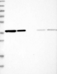 NBP1-84873 - EIF3I / EIF3S2