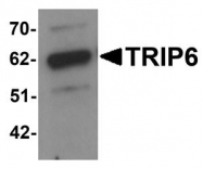 NBP1-76305 - TRIP6 / OIP1