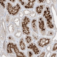 NBP1-88250 - TRMT11 / C6orf75