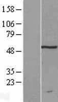 NBL1-17322 - TRM11 Lysate