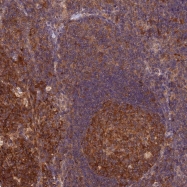 NBP1-82197 - TRMU / TRMT1