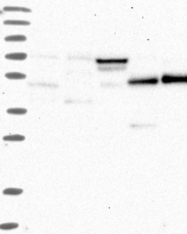 NBP1-82197 - TRMU / TRMT1