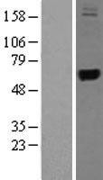 NBL1-17326 - TRMT1 Lysate