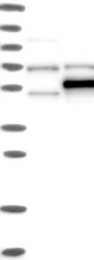 NBP1-82909 - TRMT5