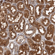 NBP1-83641 - TRMT61B